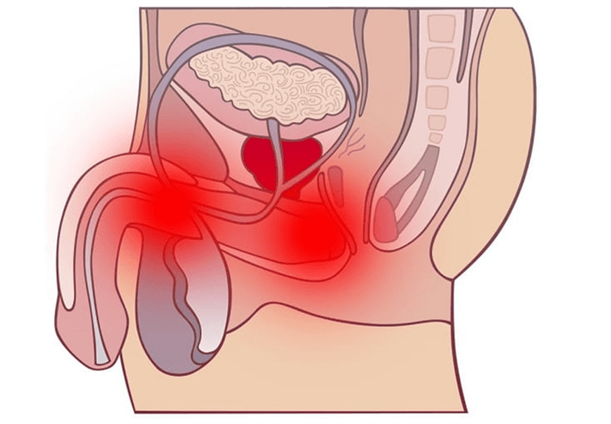 възпаление на гениталния тракт с простатит